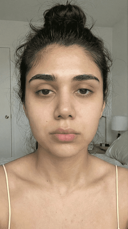 Before starting collagen