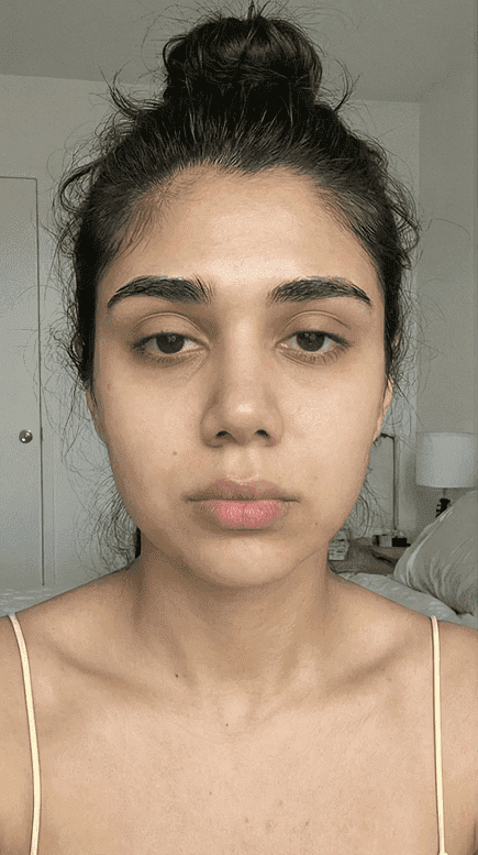 Before starting collagen